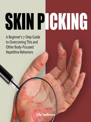 cover image of Skin Picking
